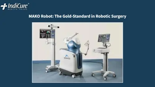 The MAKO robotic platform, the gold standard for high-precision orthopedic surgery, featuring real-time tracking eyes and advanced haptic feedback technology.